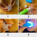 Dental Whitening Gel with LED Light Booster